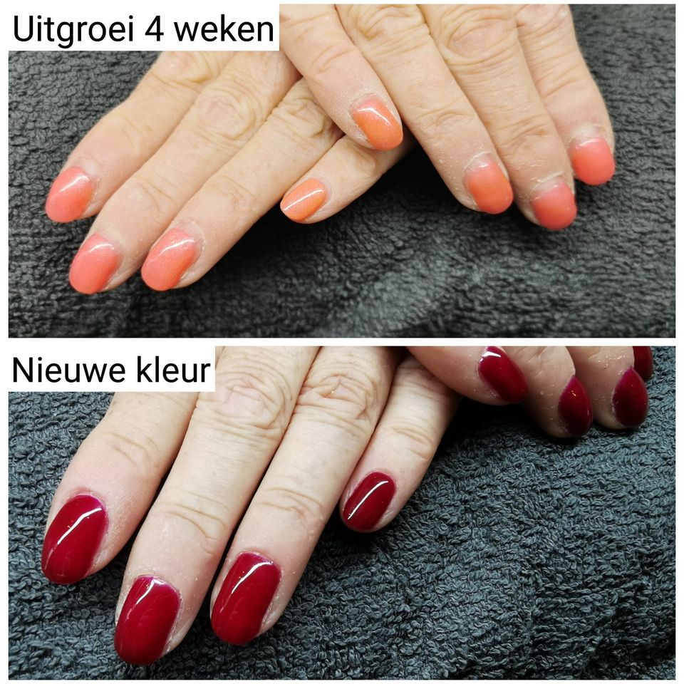 Nagels