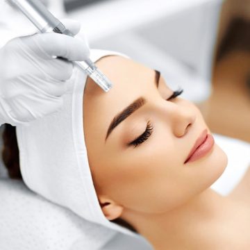 microneedling auricskincare